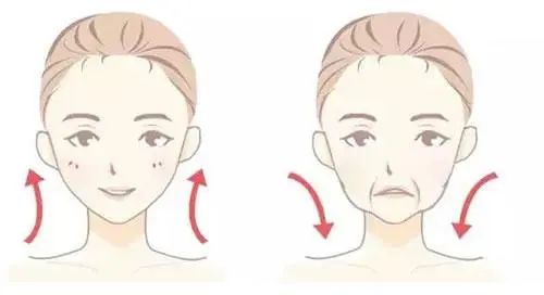 拉皮除皱手术值不值得做？衰老更快原理十年之后安全吗恢复(图1)